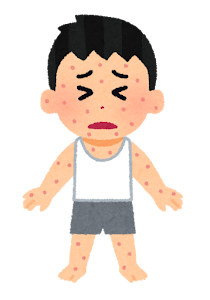 慢性じんましんに漢方